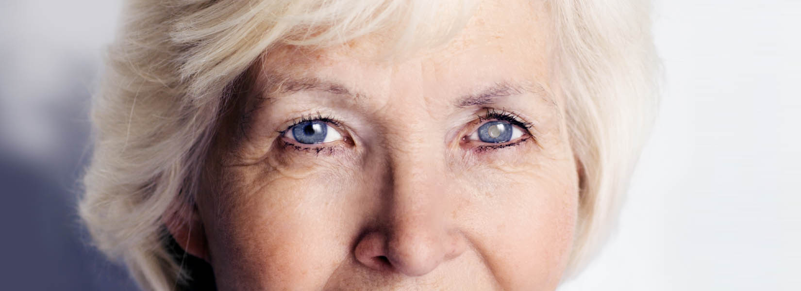 Cataract Surgery in Lakepointe Center